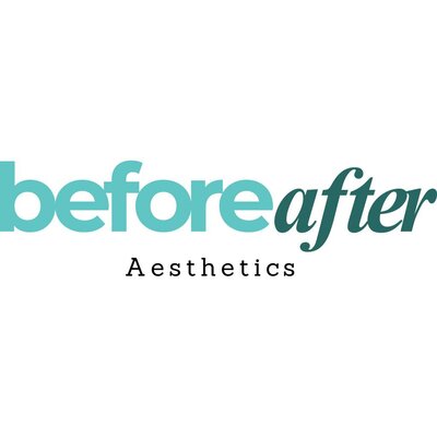Trademark beforeafter Aesthetics